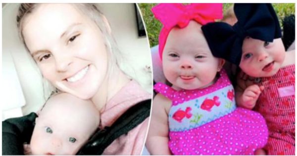 Celebrating the Beauty of Rare Twins with Down Syndrome